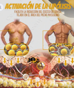 Bee Venom Gynecomastia Heating Oil 15 ml
