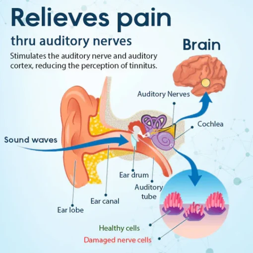 Cvreoz® Tinnitus Relief Treatment Ear Patch