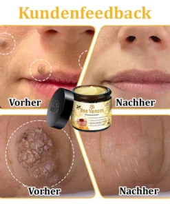 Lovilds™ Bienengift-Hautcreme
