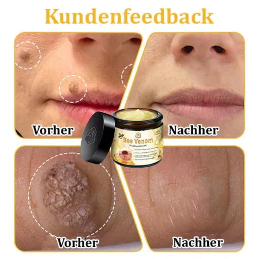 Lovilds™ Bienengift-Hautcreme