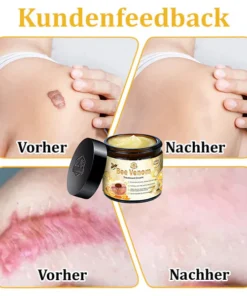 Lovilds™ Bienengift-Hautcreme