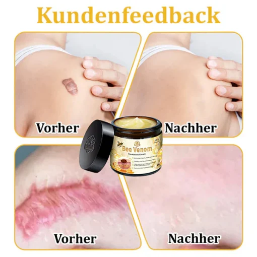 Lovilds™ Bienengift-Hautcreme