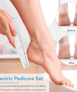 Electric Callus Remover for Feet