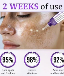 Luhaka® LumiDerma Anti-Hyperpigmentation Cream