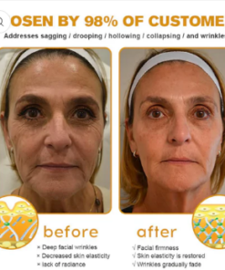 Botox Bee Venom Wrinkle Removal Cream- LAST DAY 80% OFF