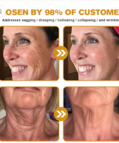 Botox Bee Venom Wrinkle Removal Cream- LAST DAY 80% OFF