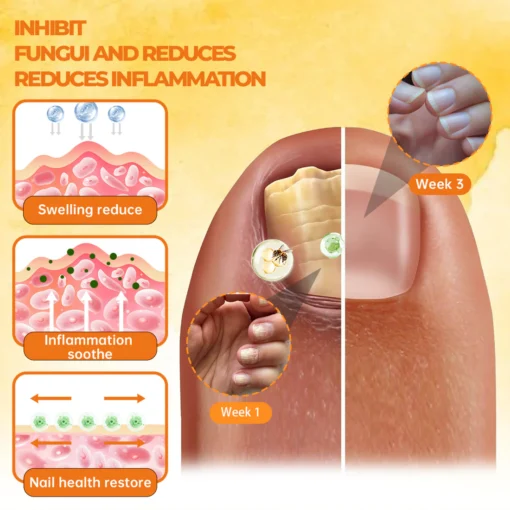 Cvreoz®Bee Venom Nail Renewal Spray