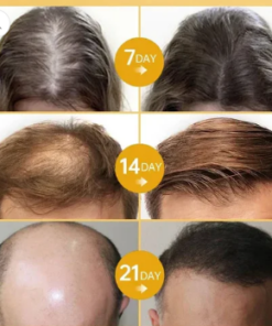 LOVILDS™ Rosemary Hair Growth Essence 100% Natural Hair Growth
