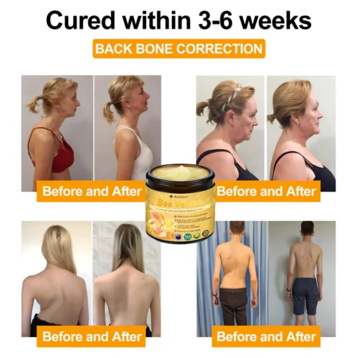 Raindew®Bee Venom Advanced Joint and Bone Healing Cream