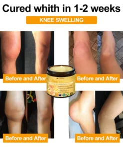 Raindew®Bee Venom Advanced Joint and Bone Healing Cream