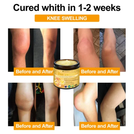 Raindew®Bee Venom Advanced Joint and Bone Healing Cream
