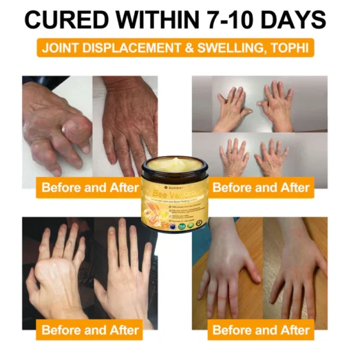 Raindew®Bee Venom Advanced Joint and Bone Healing Cream