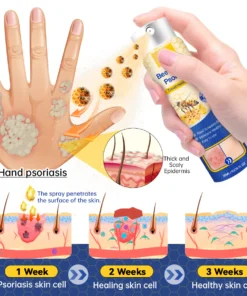 LOVILDS™ PsoriaHeal Psoriasis Spray