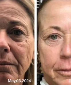 Bee Venom Age-Defying Cream