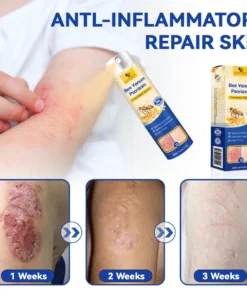 LOVILDS™ PsoriaHeal Psoriasis Spray