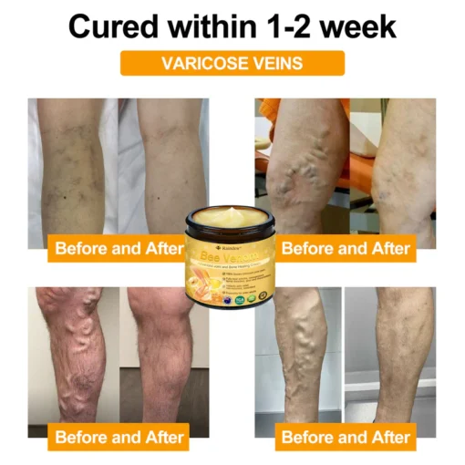 Raindew®Bee Venom Advanced Joint and Bone Healing Cream