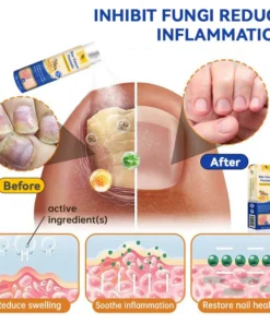 LOVILDS™ PsoriaHeal Psoriasis Spray