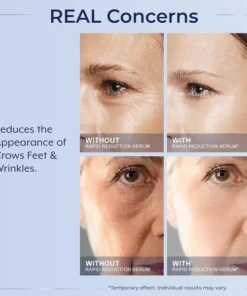 LOVILDS™ Instant Wrinkle Eye Tightener cream