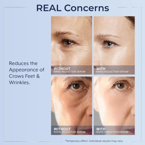 LOVILDS™ Instant Wrinkle Eye Tightener cream