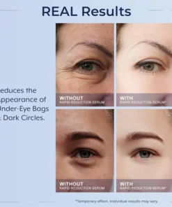 LOVILDS™ Instant Wrinkle Eye Tightener cream