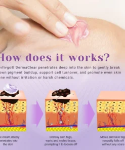 Fivfivgo® DermaClear Mole and Dark Spot Removal Bio-Gel