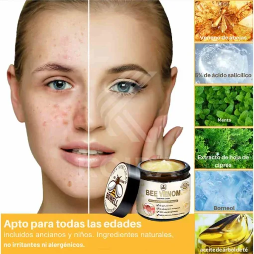 Bee Venom BSWELL™ - Bee Venom Skin Treatment Cream