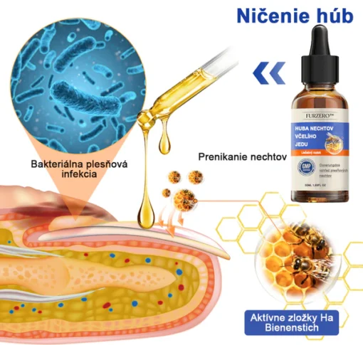 Furzero™ Bee Venom for Nail Fungus