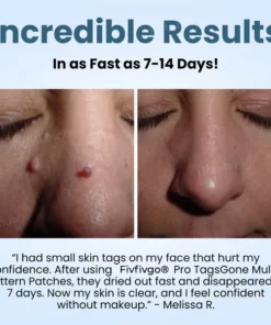 Fivfivgo® Pro TagsGone Multi-Pattern Patches