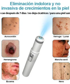 Non-invasive laser pen for mole and wart removal (atravor™)