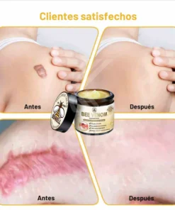 Bee Venom BSWELL™ - Bee Venom Skin Treatment Cream