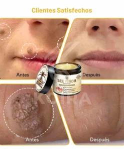 Bee Venom BSWELL™ - Bee Venom Skin Treatment Cream