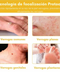 Bee Venom BSWELL™ - Bee Venom Skin Treatment Cream