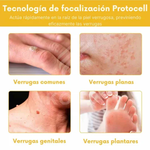 Bee Venom BSWELL™ - Bee Venom Skin Treatment Cream