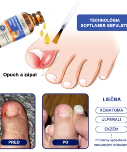 Furzero™ Bee Venom for Nail Fungus