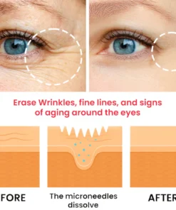 Dobshow® Snake Venom Peptide Microneedle Anti-Wrinkle and De-Puffing Eye Patch