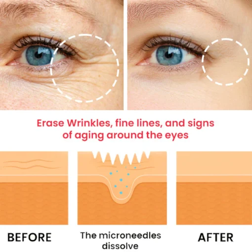 Dobshow® Snake Venom Peptide Microneedle Anti-Wrinkle and De-Puffing Eye Patch