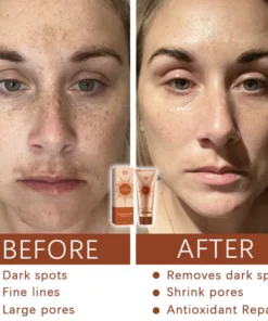 Fivfivgo™ Herbal Spots Peel-Off Facial Mask