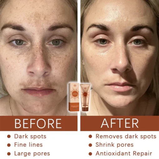 Fivfivgo™ Herbal Spots Peel-Off Facial Mask