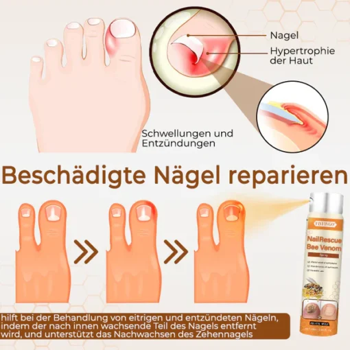 Fivfivgo® NailRescue Bee Venom Spray