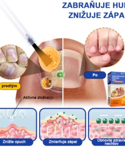 Furzero™ Bee Venom for Nail Fungus
