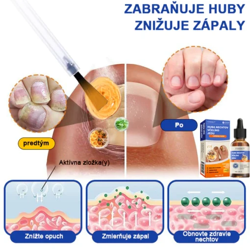 Furzero™ Bee Venom for Nail Fungus