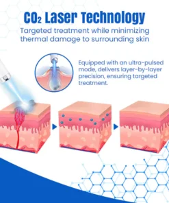 Bikenda® DermZap Mole & Wart Removal Laser Pen