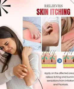 PsoriaHeal Bee Venom Psoriasis Treatment Spray