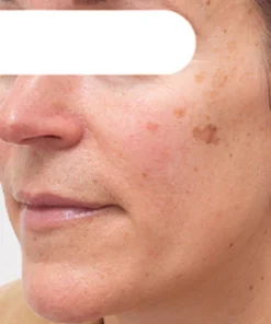 Fivfivgo™ Herbal Spots Peel-Off Facial Mask