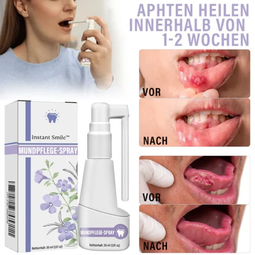 Instant Smile™ Clove Oil Oral Care Spray