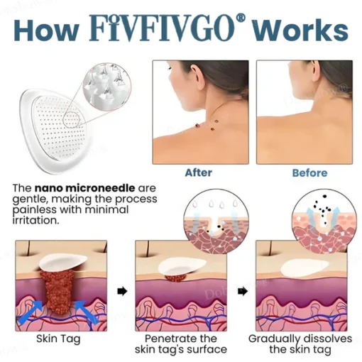Fivfivgo® Pro TagsGone Multi-Pattern Patches