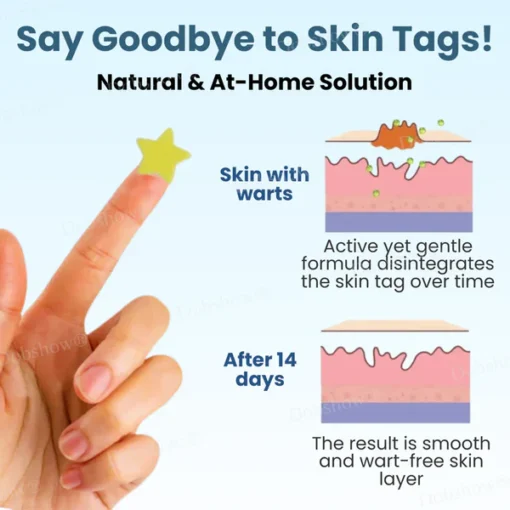 Fivfivgo® Pro TagsGone Multi-Pattern Patches