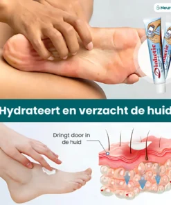 NeuroDiab™ Diabetic Nerve Cream
