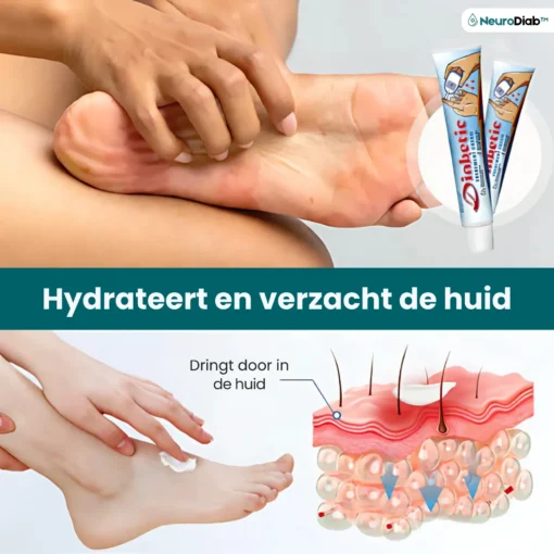 NeuroDiab™ Diabetic Nerve Cream