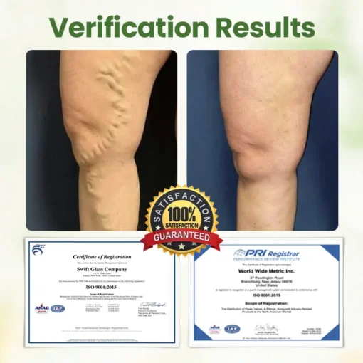 Biancat™ Lymphatic Detox Herbal Cream | Relieves Circulatory Problems in 5 Minutes